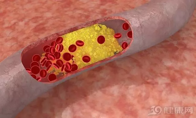 3種食物是血管的「菜」!經常吃,血管幹凈老得慢