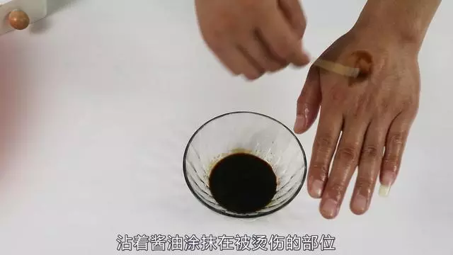 不小心被燙傷怎麼辦?別慌,教你一招,快速止痛不留疤