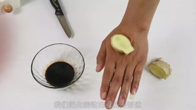 不小心被燙傷怎麼辦?別慌,教你一招,快速止痛不留疤