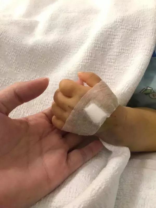 等到了 小子謙等到捐肝者救命了
