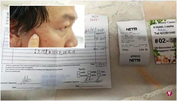 點痣RM15變RM4290配套 , 新加坡一家美容院點痣點到風波不斷,兩年內遭人投訴消協18次。