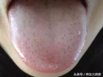 心臟不好,這個地方沒彈性,夏季養心,記住「123」口訣!