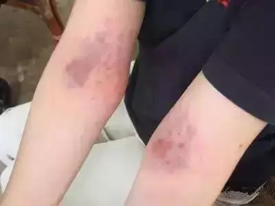 每天拍這裡,拍出腎毒,腸毒,肝臟毒,毒素一下就清得乾乾淨淨~ 連醫生都讚不絕口!