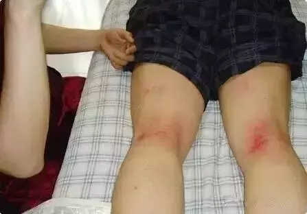 每天拍這裡,拍出腎毒,腸毒,肝臟毒,毒素一下就清得乾乾淨淨~ 連醫生都讚不絕口!