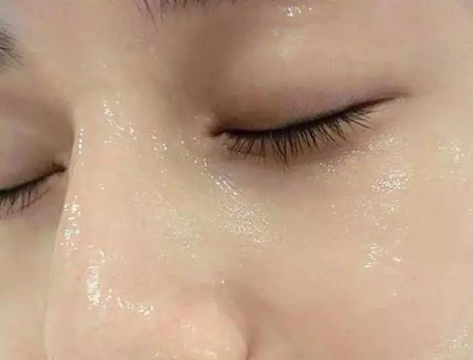 「它」是斑點皺紋的剋星,米醋加點它,老年斑、妊娠斑、雀斑、青春痘不見了好神奇