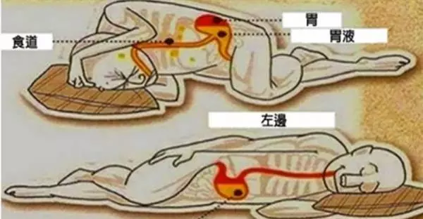 睡覺躺左側還是右側? 小心睡錯邊造成「淋巴堵塞」!醫生說這樣躺才長壽