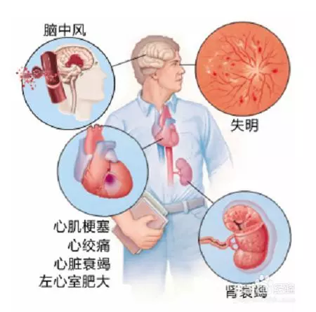 晚餐少吃就健康？錯誤晚餐5大傷害知道嗎，正確晚餐這樣的？