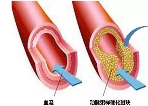 雞蛋吃多的壞處竟然這麼多,每天吃幾個雞蛋最合適?