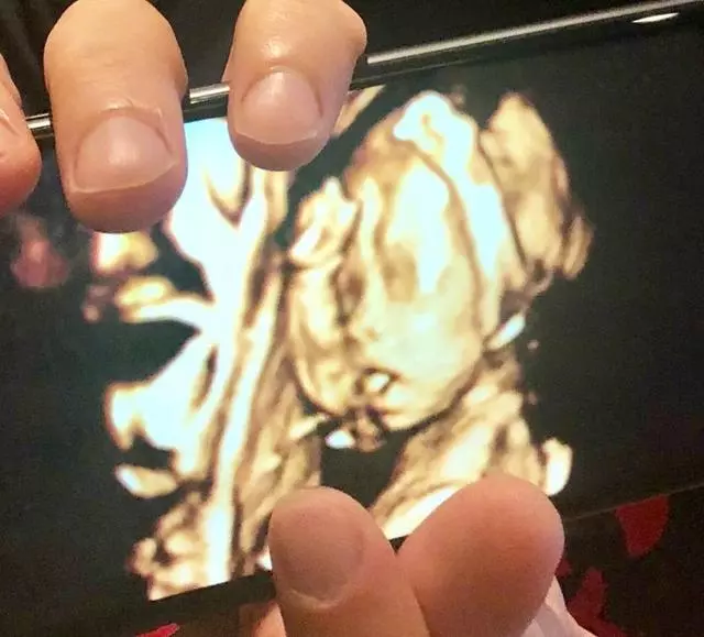 王力宏曬老婆三胎B超照,求網友給兒子取名,評論笑慘了!