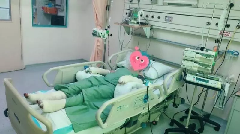 【好友FB還原事情真相!】大馬24歲正妹被男友潑汽油,全身60%被燒傷!
