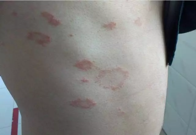 得肝癌前一個月,身體會有個最好認的徵兆,一旦出現就需警惕