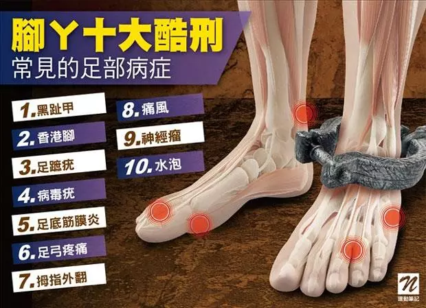 跑步、健走必看!常遇到的「腳丫十大病症」
