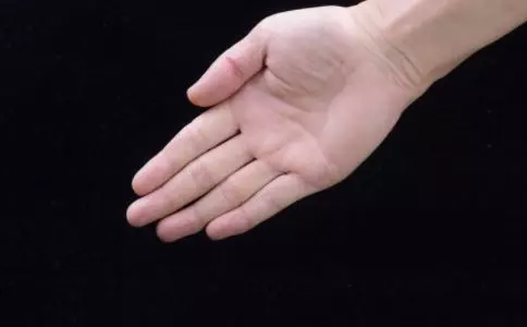 女人手心老出汗 小心這6個原因