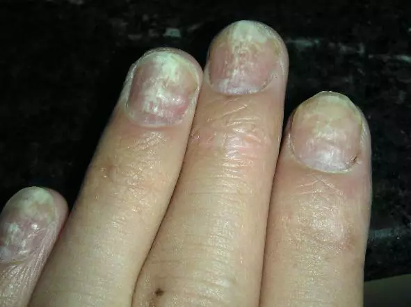 這病不痛不癢一旦發現就是晚期!5個前期表現必知,可保命 !