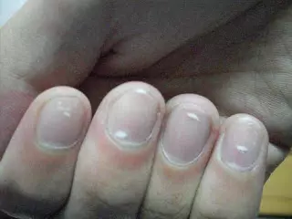 醫生:如果你睡覺時沒有這3種情況,說明你的肝臟非常健康。