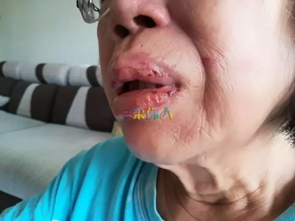 老婦半夜尿急如廁遇竊賊 遭掌嘴毆打 更險些壓枕送命