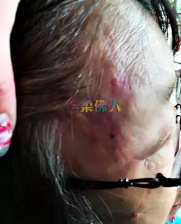 老婦半夜尿急如廁遇竊賊 遭掌嘴毆打 更險些壓枕送命