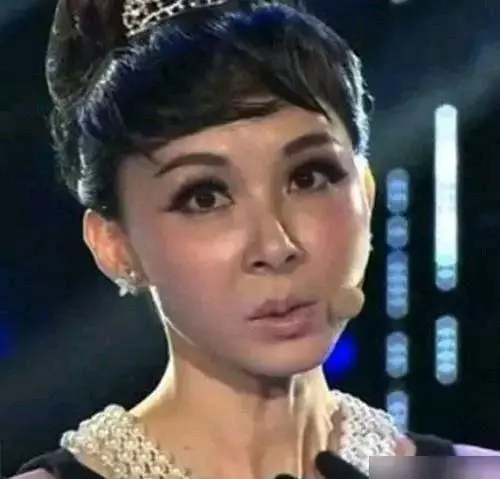 女星都是假凍齡?關之琳面部僵硬,趙雅芝滿臉皺紋,她讓人認不出!