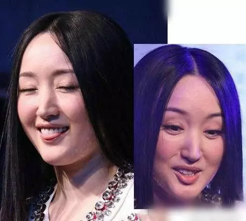 女星都是假凍齡?關之琳面部僵硬,趙雅芝滿臉皺紋,她讓人認不出!