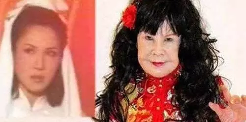 女星都是假凍齡?關之琳面部僵硬,趙雅芝滿臉皺紋,她讓人認不出!