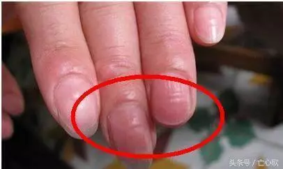 它是肝毒的「解毒王」, 每天吃一點,肝炎、肝硬化不攻自破