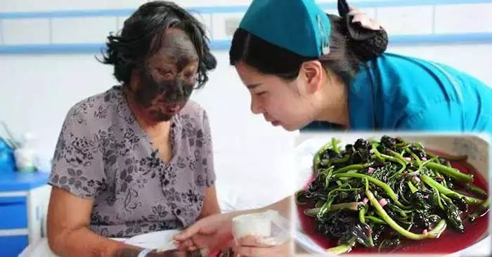 她吃了「這種菜」,變成「大黑臉」還差點丟命…真的要注意了!