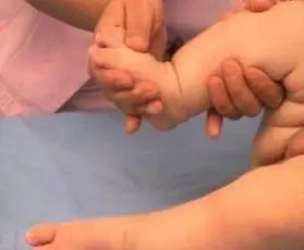 腦癱患者手術後,要如何康復訓練?要注意什麼?