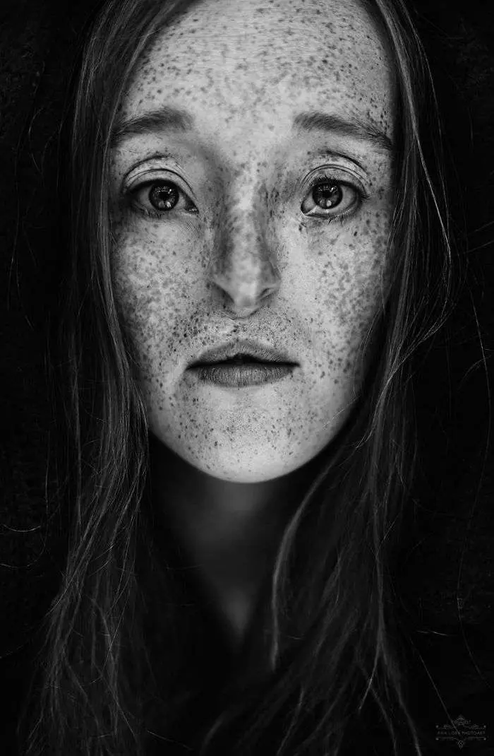 26歲女模打破既有審美觀 「世界上只有一種丑,那就是你內心的醜陋」