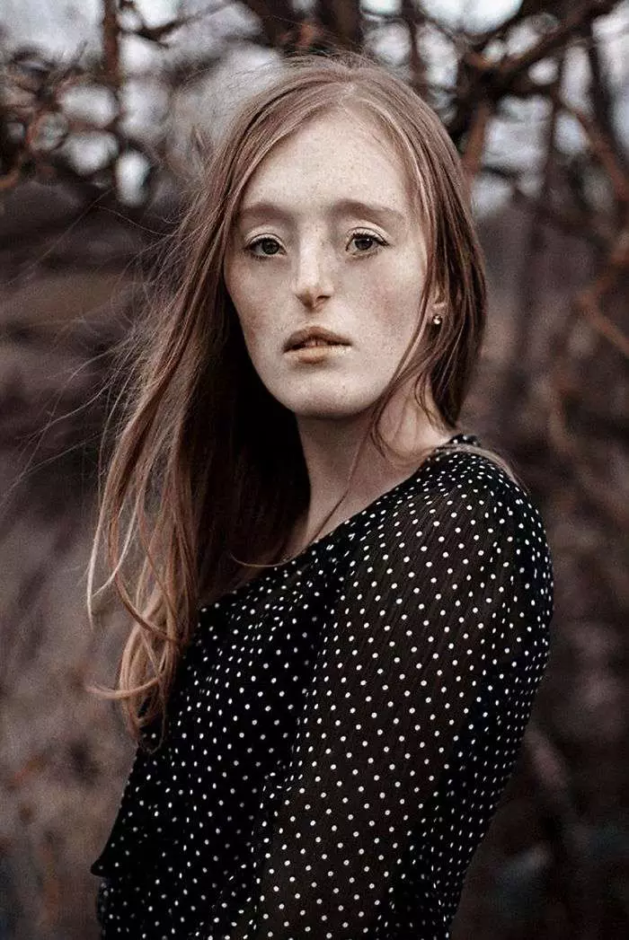 26歲女模打破既有審美觀 「世界上只有一種丑,那就是你內心的醜陋」