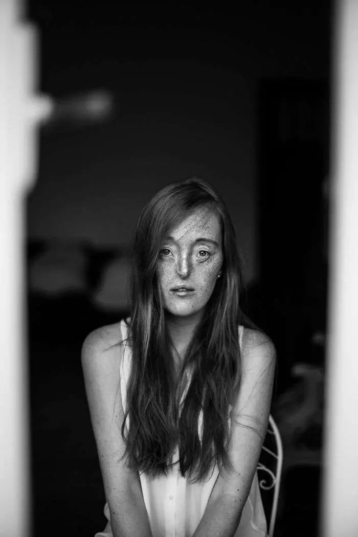26歲女模打破既有審美觀 「世界上只有一種丑,那就是你內心的醜陋」