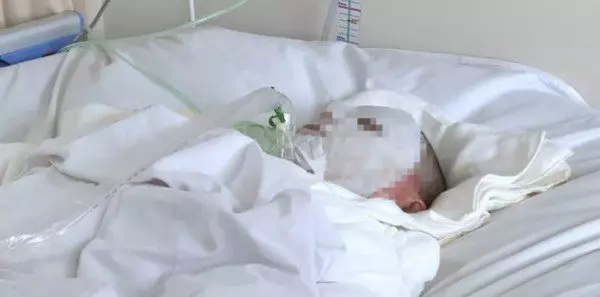 母親情敵破門捆綁雙腳 少女遭熱水灌嘴燒爛喉