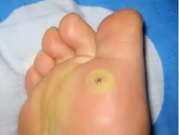 把萬金油凃在大腿上，效果簡直太棒了，看完你會感謝我的