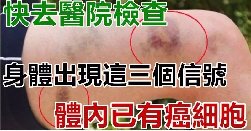 身體出現這三個信號,體內已有癌細胞,快去醫院檢查