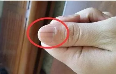 身體出現這三個信號,體內已有癌細胞,快去醫院檢查