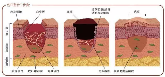 受傷以後,真的不能吃海鮮和「發物」嗎?