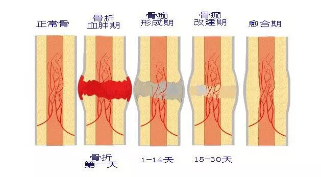 受傷以後,真的不能吃海鮮和「發物」嗎?