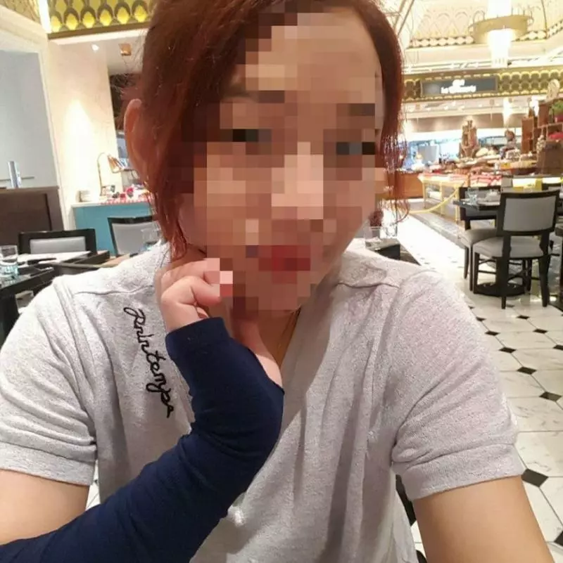 【大馬年輕媽媽親身經歷!!】第一次用『這瓶』來通洗手盆竟發生爆炸!全身嚴重被灼傷還留疤!