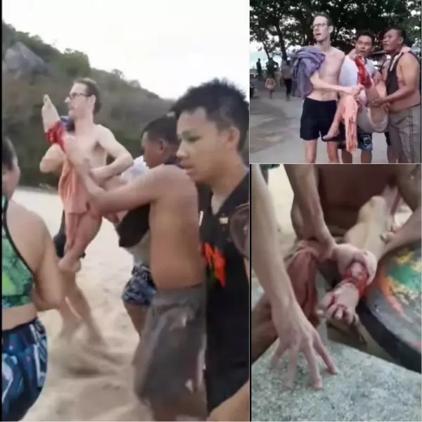 嚇人!IG美模仰泳拍照 遭鯊魚咬手拖入海中