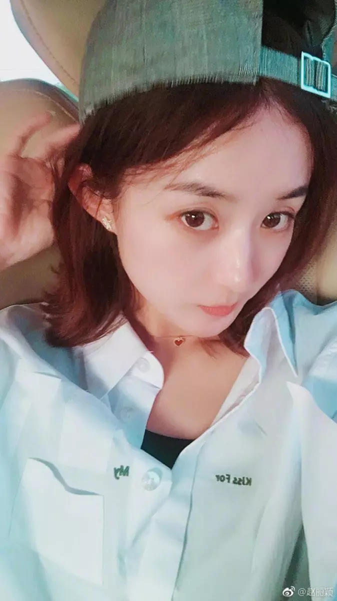 趙麗穎後腦血栓!剛開始不以為意, 看了醫生才知道嚴重性, 宣布停工不再接戲!