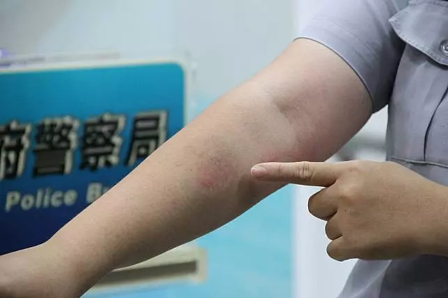 【咬警事件全整理】蔣月惠從噓聲到掌聲 幫「羅騰園」撐起一片天