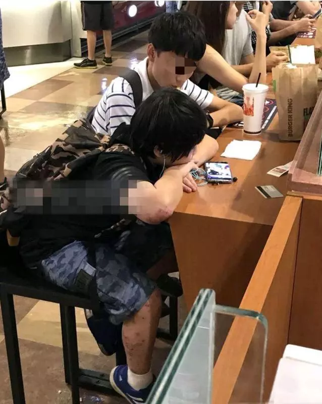 14歲小小彬被爸爸當搖錢樹來還房貸養全家!如今近照曝光,手腳潰爛令人心疼!