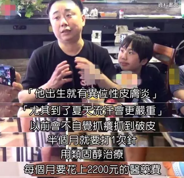 14歲小小彬被爸爸當搖錢樹來還房貸養全家!如今近照曝光,手腳潰爛令人心疼!