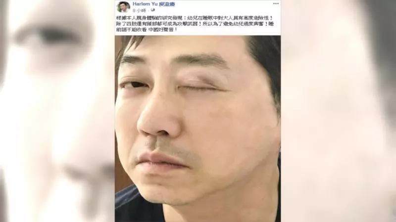 庾澄慶曝被家暴 右眼瘀青腫脹