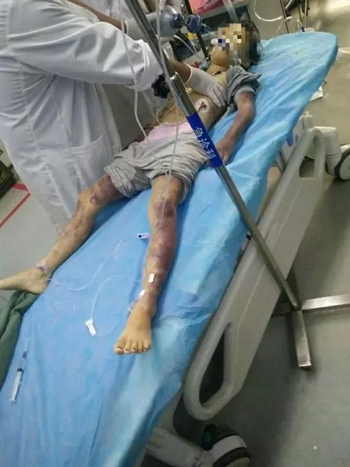 父鞭打1小時殺6歲女 醫師看了落淚
