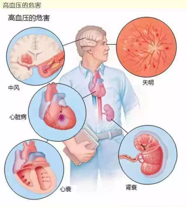 血壓高的人注意,5種食物不要多吃,會讓血壓「直線飆升」