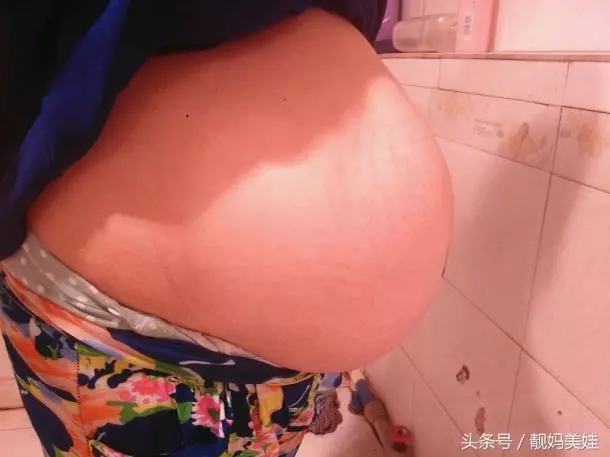 雙胞胎女翻男,護士出產房報喜後,沒想到7個家屬卻沒一個人高興
