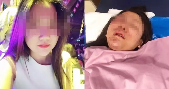(內有視頻看)女女戀「交往7年」談分手生恨!清秀女孩被打成豬頭 影片曝光