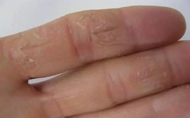玉米被稱為「長壽食物」,但5類人吃了傷身,查查看,你在其中嗎