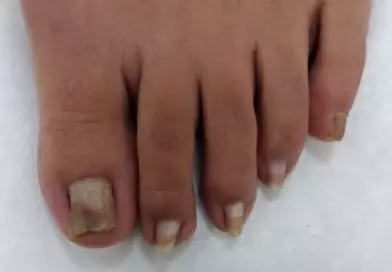 少女胸腹部驚見神秘雙手 還要替它剪指甲!
