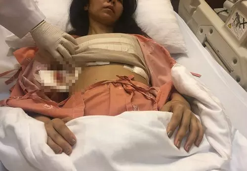 [ 泰國 ] 赴韓隆胸手術失敗險死 女歌手怒告院方 求償244萬